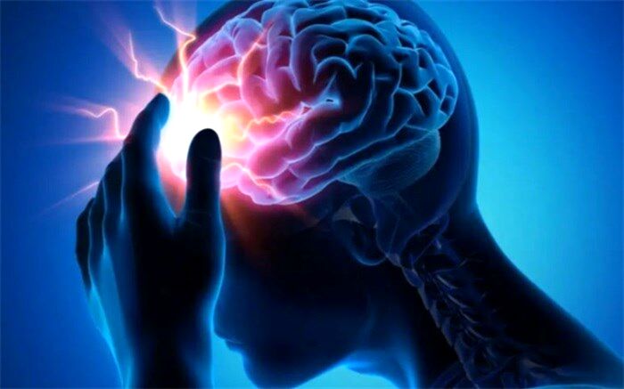 کدام عوامل می‌تواند بروز سکته مغزی را در افراد کاهش دهد؟