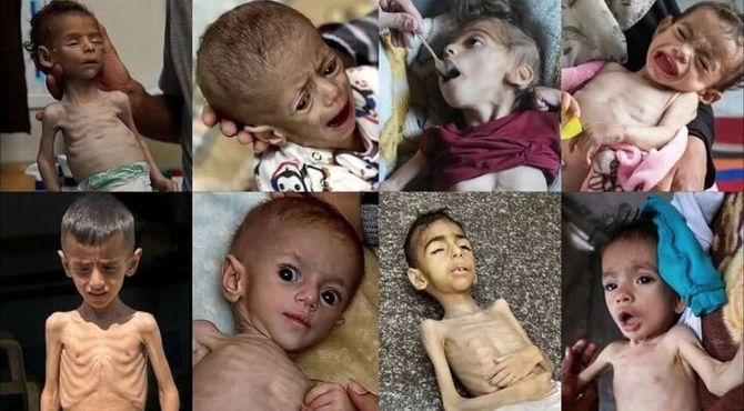 در غزه گرسنگی وجود ندارد!