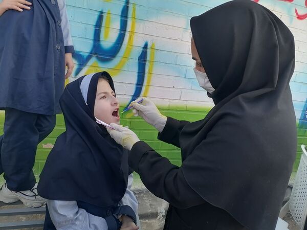 وارنیش فلوراید برای دانش آموزان دبستان ناهید نخودی 