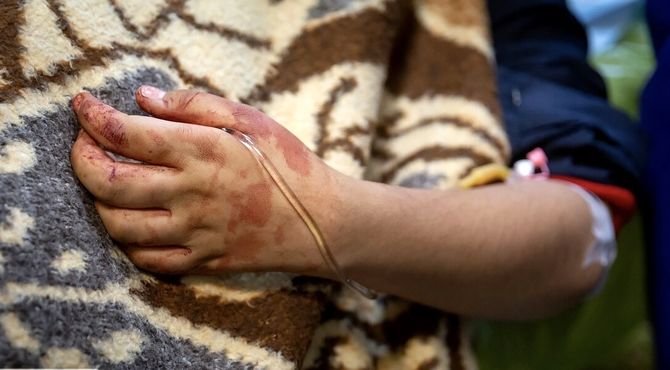 پذیرش و درمان رایگان مصدومان حوادث اخیر در مراکز درمانی کشور