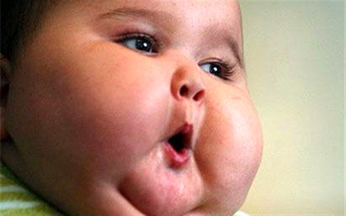 خطرات چاقی در کودکان