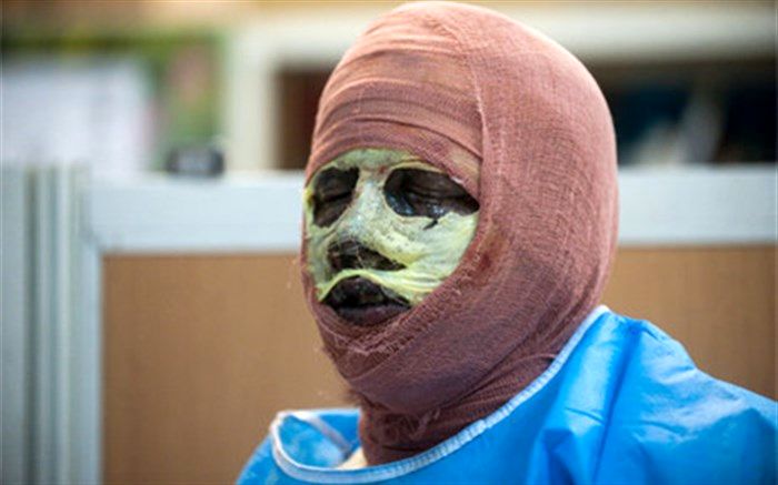 آمار جدید از تلفات و جراحت‌های چهارشنبه سوری اسفند 96