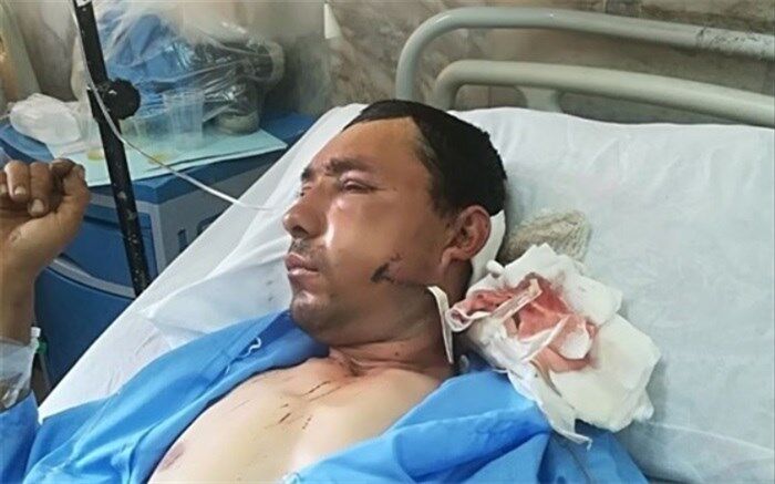 حال مرد آسیب‌دیده در پی حمله پلنگ در کلاله مساعد است