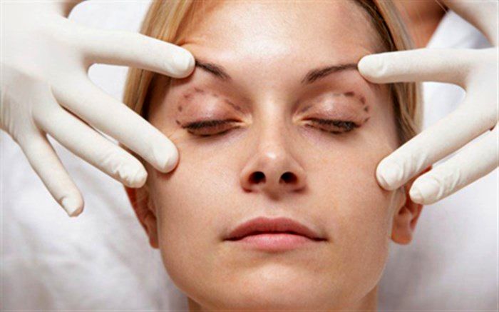 جراحی زیبایی «گوش الاغی» به ایران رسید + ویدئو