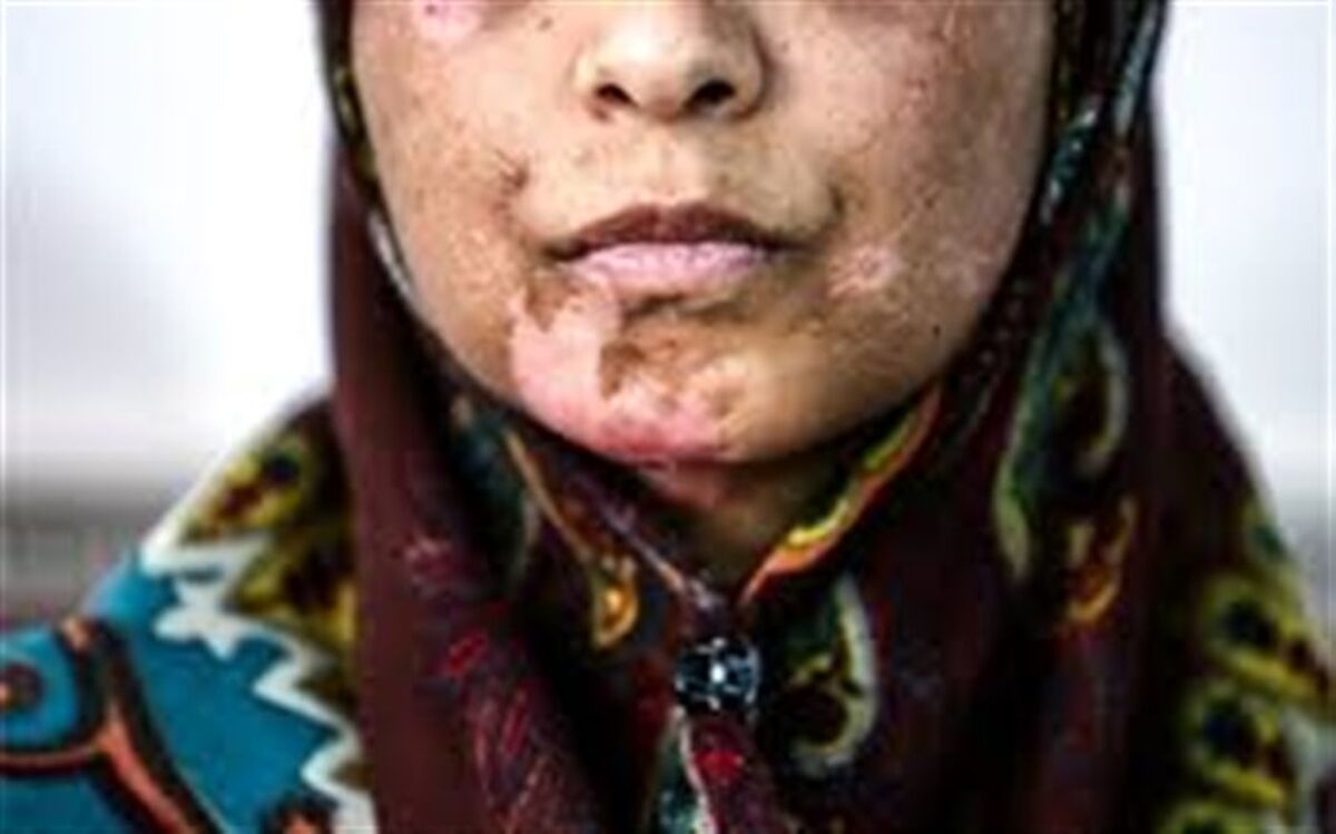 دلیل تعلل قوه قضاییه در ارسال لایحه «تامین امنیت زنان در برابر خشونت» به مجلس چیست