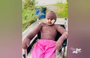 «هدا»، دختری از میناب/ مستندی درباره یکی از بازماندگان جنگ رمضان