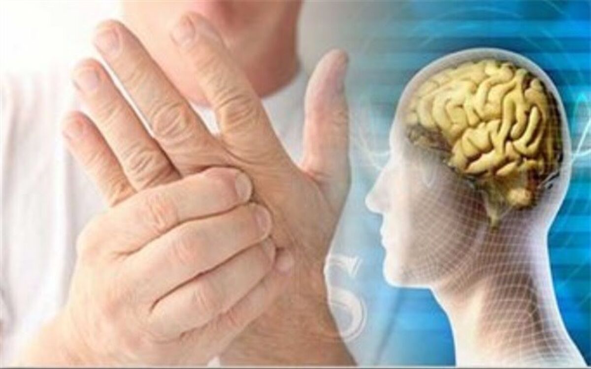 زنان بیشترین مبتلایان به ام.اس