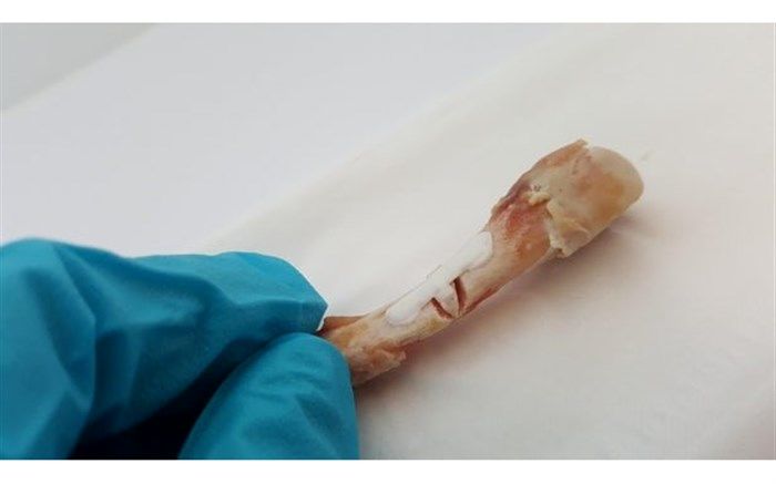 دوزانو و چهارزانو نشستن باعث آرتروز می‌شود؟