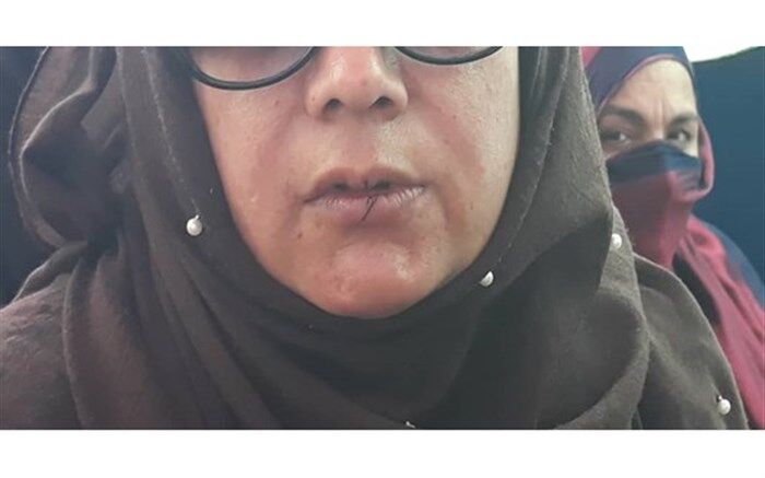 نامزدهای معترض انتخابات مجلس افغانستان لب‌های خود را دوختند