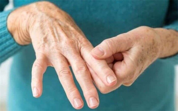 بیش از 40 درصد مردم کشور از دردهای استخوانی رنج می‌برند