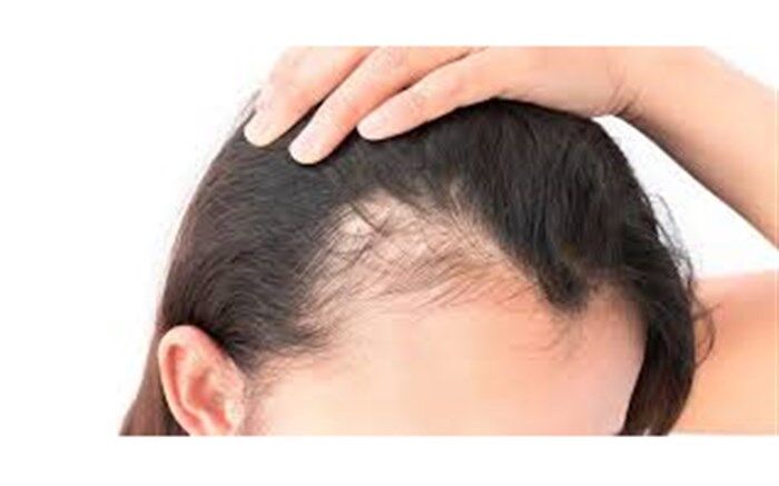 تاثیر یک غذای کره‌ای در رفع ریزش مو + تصویر