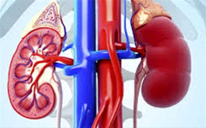 چه افرادی دچار «سنگ کلیه» می شوند