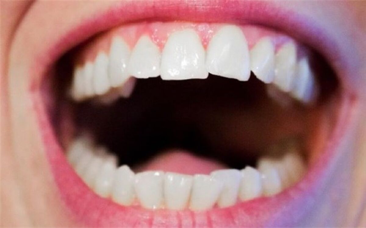 تاثیر شکل دهان افراد بر زبان گفتاری نسل‌های آینده
