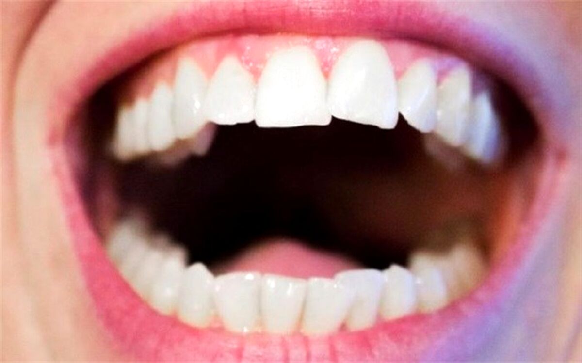 تاثیر شکل دهان افراد بر زبان گفتاری نسل‌های آینده
