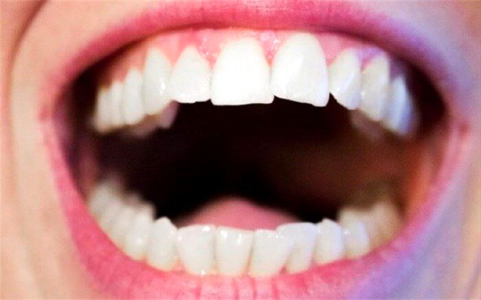 تاثیر شکل دهان افراد بر زبان گفتاری نسل‌های آینده