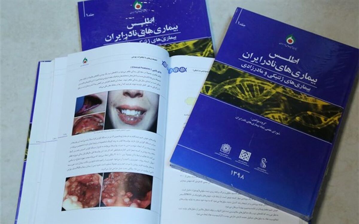 اطلس جدید بیماری های نادر منتشر شد