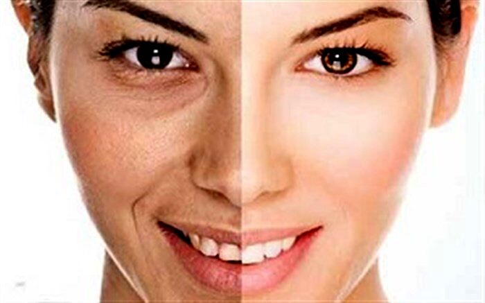 5 روش طبیعی برای کاهش چین و چروک پوست