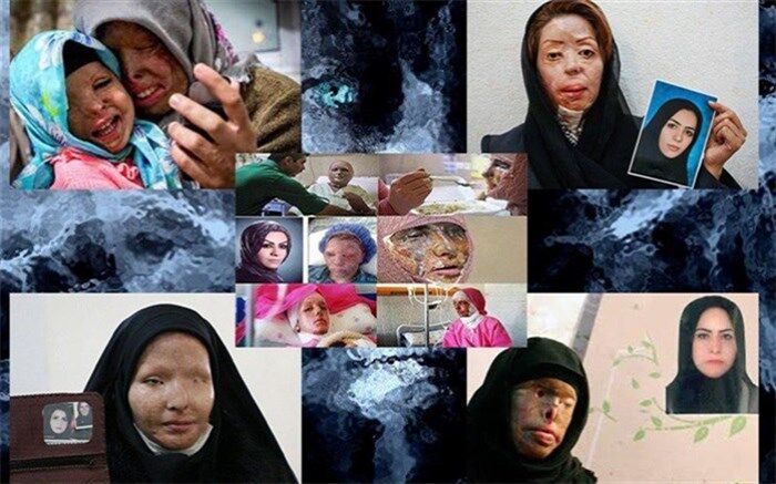 قربانیان اسیدپاشی از نگاه جامعه و دردهای خود می‌گویند