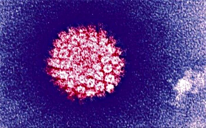 ۱۱ باور غلط درباره HPV؛ بیماری‌ای که باید آن را بهتر بشناسید