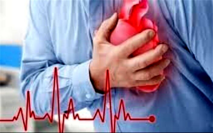 سیف‌الله عبدی: بیماران در صورت بروز علائم سکته خوددرمانی نکنند