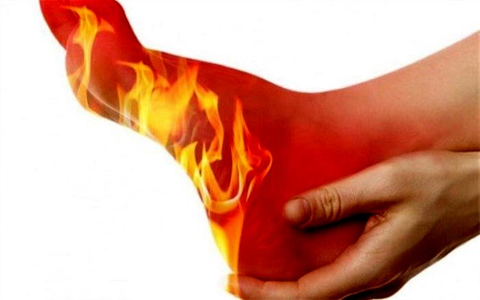 سندروم پای بی قرار چیست و چه درمانی دارد