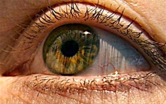 علائم و خطرات "سکته چشمی"