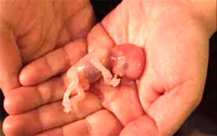 صدور 589 مجوز سقط جنین درمانی در ۶ ماهه نخست امسال در استان تهران