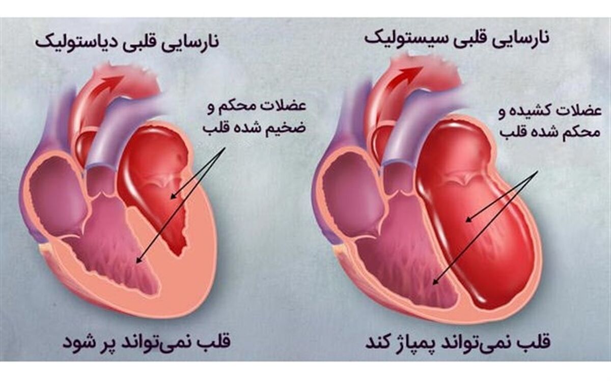 ۵ توصیه برای کسانی‌که مبتلا به نارسایی قلبی هستند