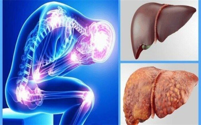 معجزه‌ای که کبدتان را از کار می‌اندازد