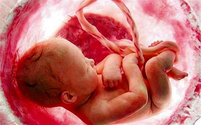 بیماری‌هایی که با خون بندناف نوزاد درمان می‌شوند