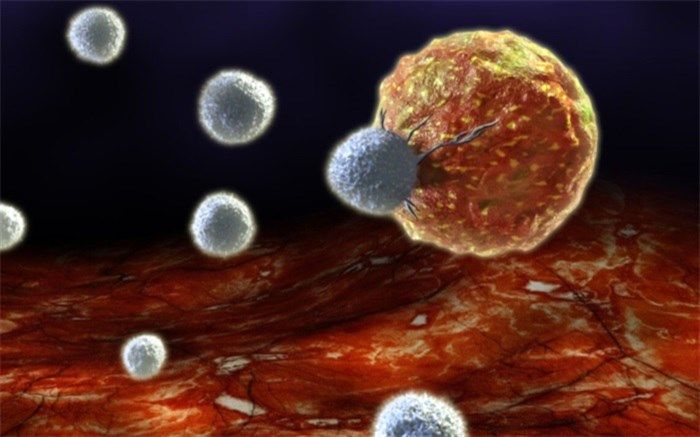 دو سوم سرطان‌ها در کشور درمان قطعی می‌شود