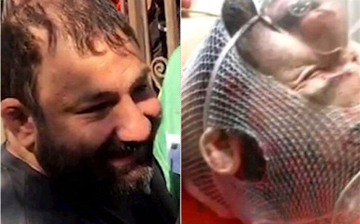 «شرور معروف» زنده است؛ آبمیوه‌ای که زهر شد + تصویر
