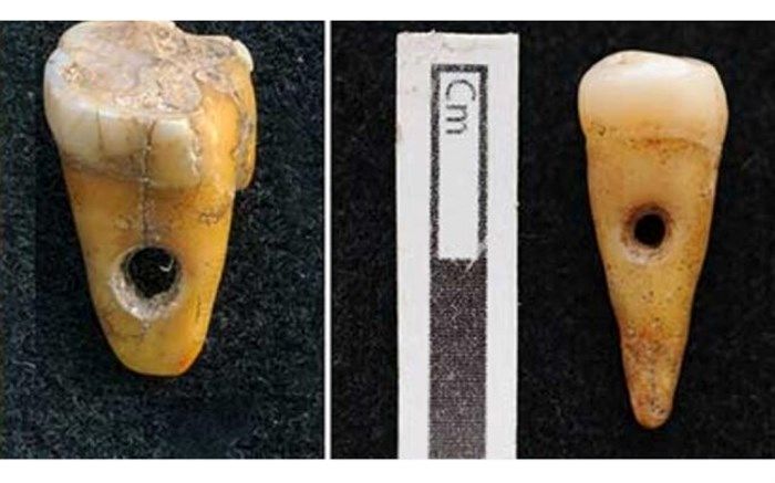 دندان‌هایی که زیورآلات شدند!