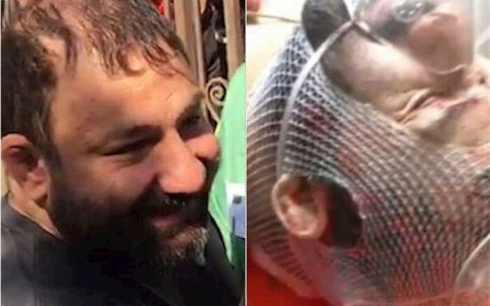 نوشته پشت در اتاق «هانی کرده» در بیمارستان + تصویر