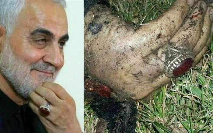 تصویر منتسب به دست و انگشتر سردار سلیمانی پس از شهادت