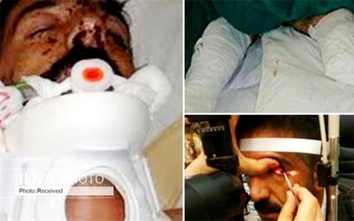 «مردم» برای لقمان وحید، سوی چشم و پای مصنوعی جور کردند