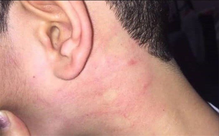 موضوع «ضرب و شتم دانش‌آموز در یکی از مدارس آذربایجان شرقی» پیگیری می‌شود