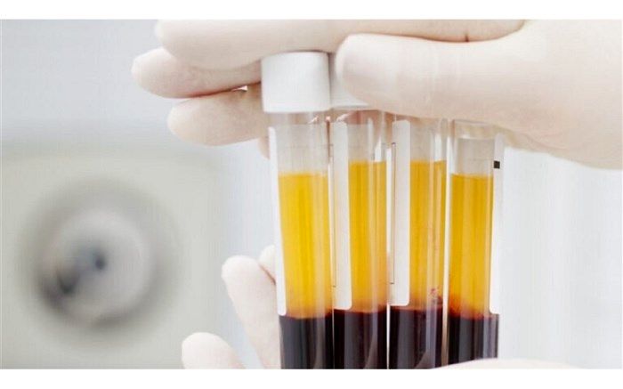 آغاز اجرای پلاسما درمانی بیماران کرونایی در استان اردبیل