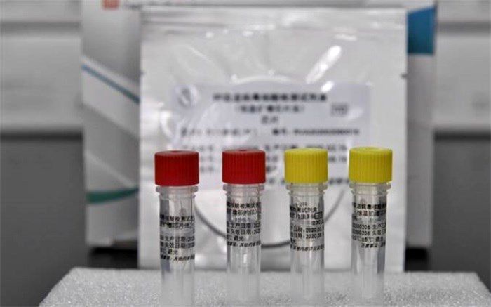 کیت تشخیصی تولید داخل کرونا تا هفته آتی وارد چرخه می‌شود