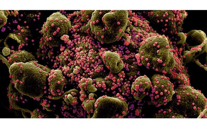 جهش ژنتیکی کووید-19 مانع از ساخت واکسن نمی‌شود