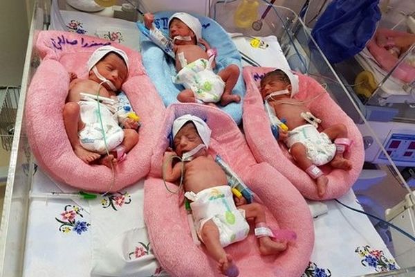 پرداخت مستمری به چندقلوهای ۷ دهک درآمدی