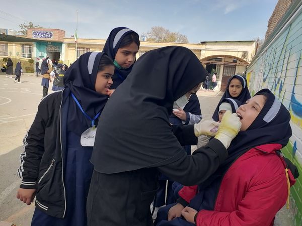 وارنیش فلوراید برای دانش آموزان دبستان ناهید نخودی 