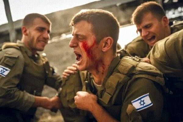 زخمی شدن یک هزار و ۶۱۹ صهیونیست از آغاز تجاوز نظامی آمریکا و اسرائیل به ایران